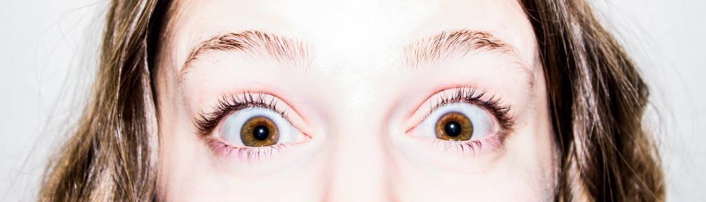 Frau mit aufgerissenen Augen brennende-Augen-pexels-Optik-Westermeier
